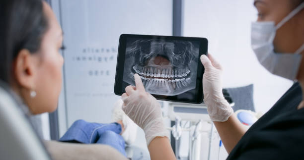 Licensed Root Canal Treatment service in Baltimore city County, MD - Smile Center Dentistry